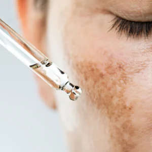 tranexamic acid skincare ingredient